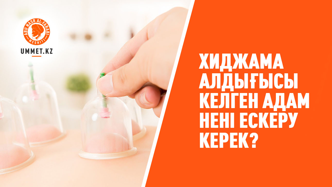 Хиджама алдығысы келген адам нені ескеру керек?