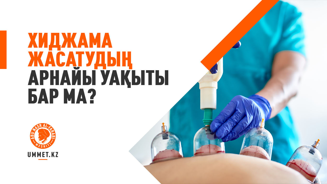 Хиджама жасатудың арнайы уақыты бар ма?