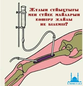 Жұлын сұйықтығы мен сүйек майларын көшіру жайлы не білеміз?