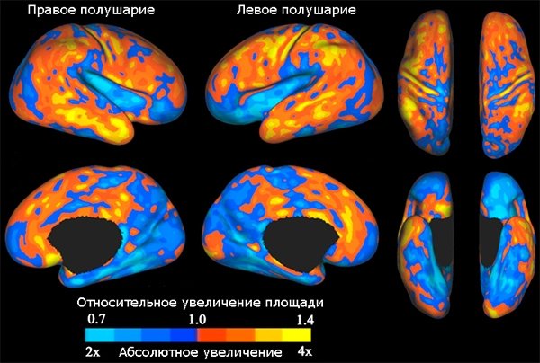 Чудо в мозге ребенка 2